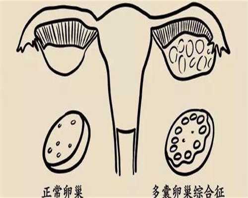 试管供卵代孕费用多少,三代试管能阻断哪些遗传疾病(家族遗传病做三代试管能