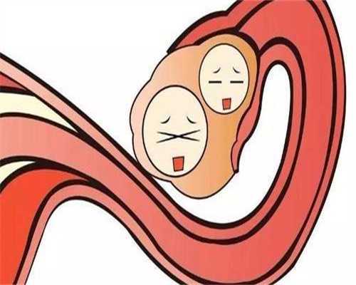 在国内单身男人可以做试管婴儿吗？附试管助孕条件一览！