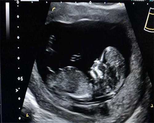 上海市助孕生个宝宝价目表！教您选择最适合你的方案