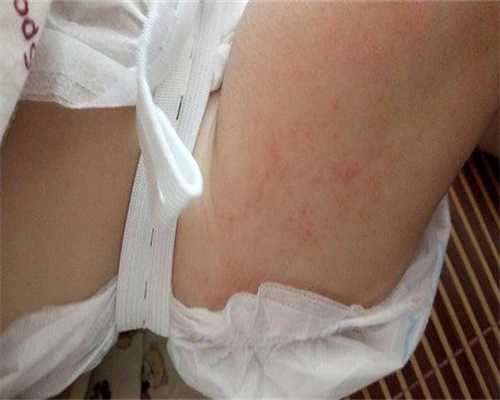 福婴国际助孕_添禧助孕靠谱吗,镇江做试管可以用医保报销多少钱