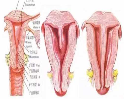 高龄借卵做试管贵吗？高龄借卵做试管的费用解读 