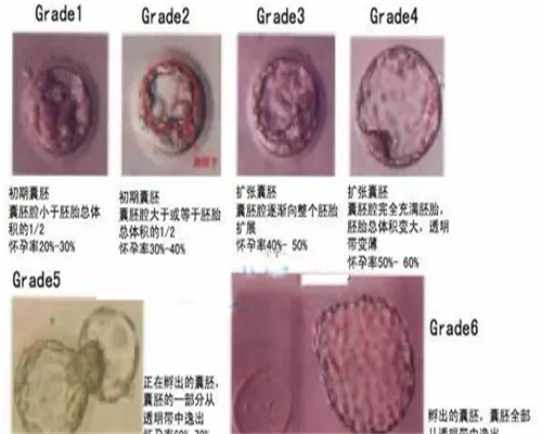  一直闭经做供卵试管婴儿能成功吗？成功率多大？ 