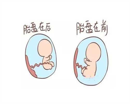 杭州助孕产子的全部费用多少，提前做好费用方面的攻略