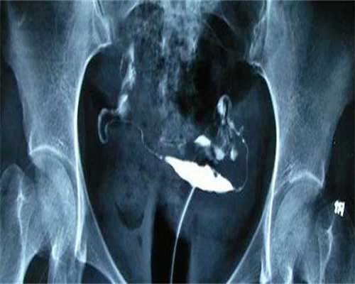 真实助孕案例分享？2026试管婴儿医院成功率排名参考！