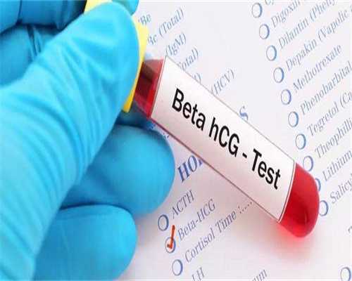 助孕生子国内有哪些规定措施？关于抚养权统统告诉你